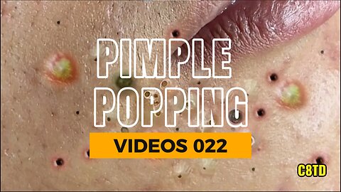 Satisfying Pimple Popping Videos 022