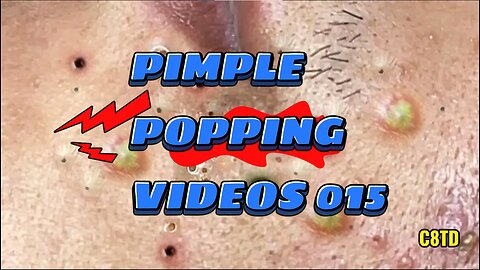 Satisfying Pimple Popping Videos 015