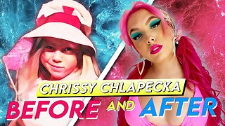 Chrissy Chlapecka | Before & After | Plastic Surgery Transformation