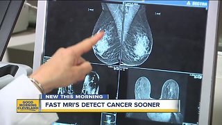 UH has a new tool that can find cancer other tests miss