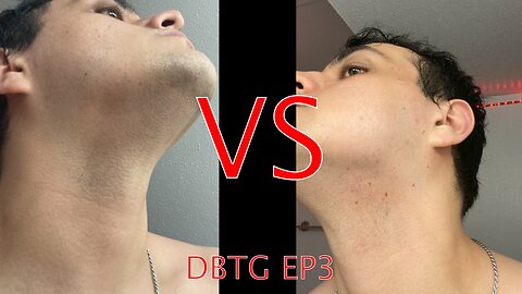 Tips when Shaving with ACNE and SENSITIVE SKIN | Don't Be That Guy Ep. 3