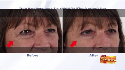 Rapidly Fix Puffy Eyes in Minutes