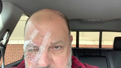 One eye done with cataract removal