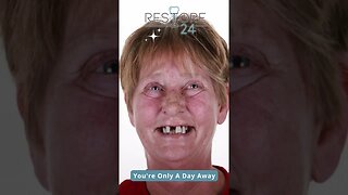 Dawn H Restore in 24 Smile Makeover