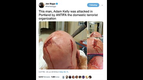 June 29 2019 Portland 2.3 Antifa mobs and severely wounds other people.