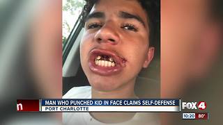 Mother upset the man who punched her 12 year-old son was not arrested