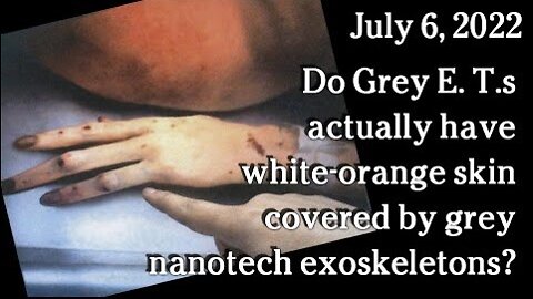 Do Grey E. T.s actually have white-orange skin covered by grey nanotech exoskeletons?