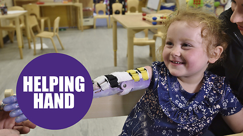 The New Bionic Arm Transforms This Girl Into A Disney Princess