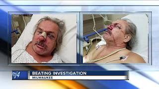 Bar fight lands partially blind Milwaukee man in the hospital