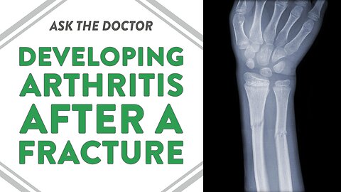 Ask the Doctor: Developing arthritis after a fracture