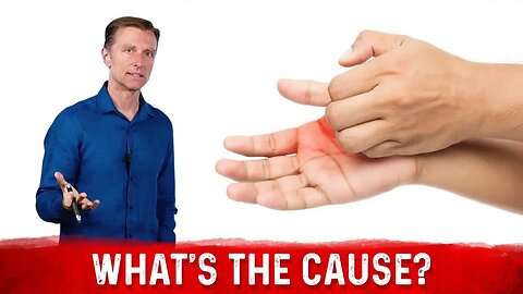 What Causes Sweaty / Dry Hands & How To Get Rid Of It? – Dr. Berg