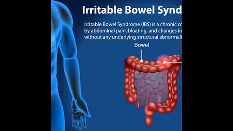 Understanding IBS Causes, Symptoms, and management