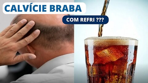 Beber um refrigerante por dia causa calvície?!