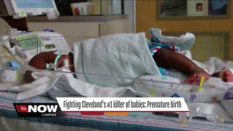 Fighting premature births in Cleveland