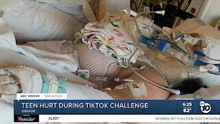 Teen hurt during TikTok fire challenge