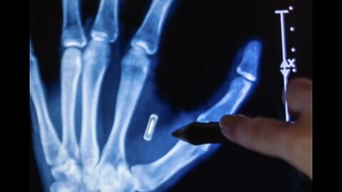 BEAST TECHNOLOGY: Human microchip implants take center stage!