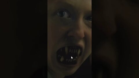 She Got Them British ''Well At Least'' Werewolf Teeth!