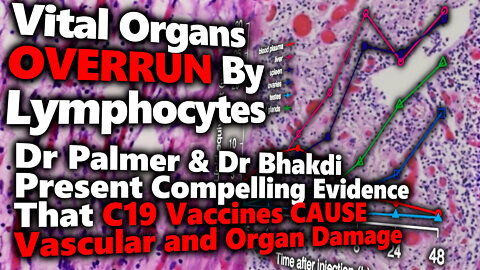Dr Bhakdi & Dr Palmer's Compelling Evidence That C19 Vaccines CAUSE Vascular and Organ Damage
