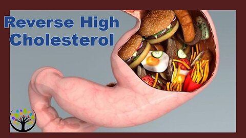 The Secret To Reverse High Cholesterol