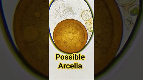 Possible Arcella