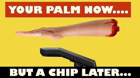 Pay With You Palm Now, And With A Chip Later