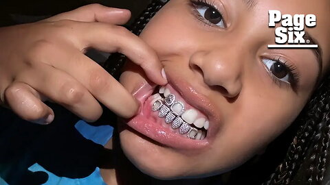 North West, 10, shows off diamond grills as dad Kanye debuts $850K titanium dentures