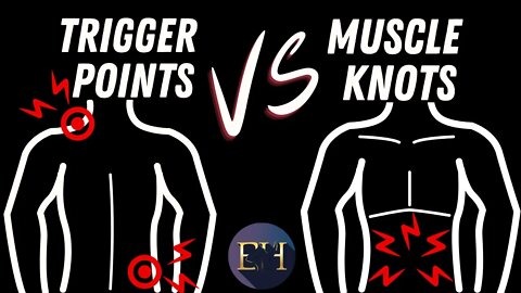 What's the difference between Trigger Points vs Muscle knots | Knots and trigger point TrP explained