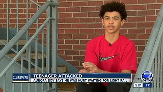 13-year-old boy says man attacked him at Aurora light rail station; police now investigating