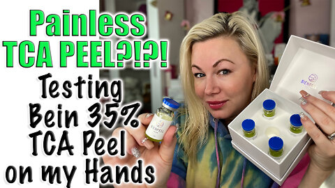 A Painless TCA Peel? Testing Bein 35% TCA Peel on my Hands www.acecosm.com | Code Jessica10 saves $$