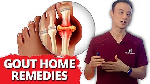 FAST RELIEF Home Remedies for Gout!