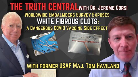 A Worldwide Embalmers Survey Exposes White Fibrous Clots a deadly COVID Vaccine Side Effect