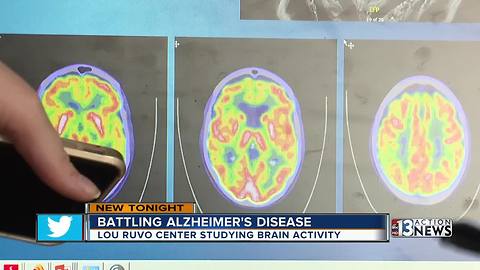 Las Vegas researchers pushing ground-breaking Alzheimer's research forward