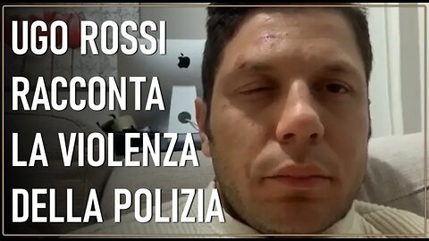 Ugo Rossi agli arresti domiciliari racconta le violenze subite dalla Polizia Locale di Trieste