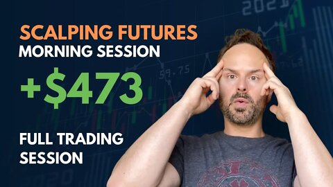WATCH ME TRADE (Full Session) | +$473 WIN | DAY TRADING Nasdaq Futures Trading Scalping Day Trading