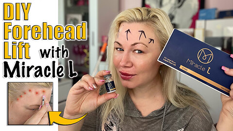 DIY Forehead Lift with Miracle L from AceCosm.com : Round 2 | Code Jessica10 Saves you Money!