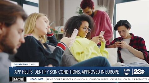 App helps identify skin conditions, approved in Europe