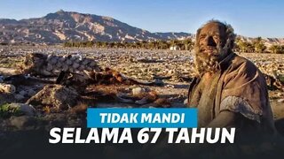 ANEH TAPI NYATA!!!! MANUSIA TERKOTOR DIDUNIA