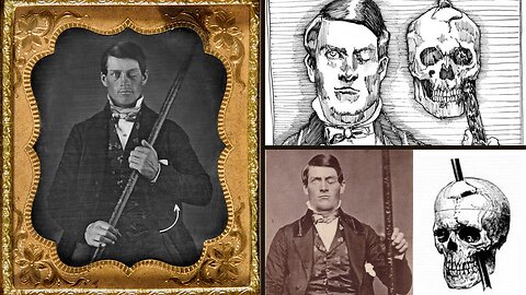 Strange Dark and Mysterious Railway Incident That Happened to Phineas Gage