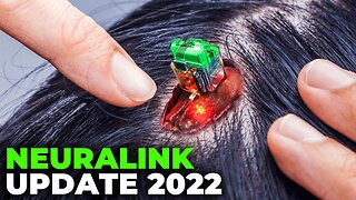 Neuralink Update New INSANE Brain Implant Begins Human Trials!