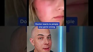 Doctor reacts to the risks of pimple popping! #pimple #pimplepopper #dermreacts