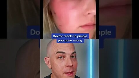 Doctor reacts to the risks of pimple popping! #pimple #pimplepopper #dermreacts