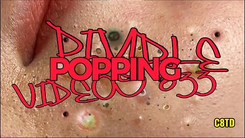Satisfying Pimple Popping Videos 033