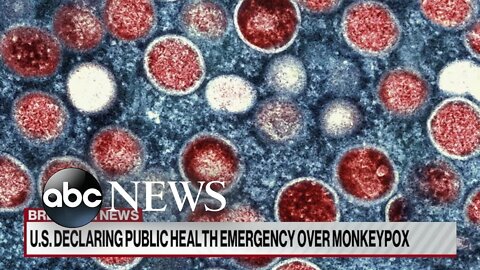 Gli USA dichiarano l'emergenza sanitaria pubblica per l'epidemia di vaiolo delle scimmie. Gli USA guidano il mondo nei casi noti di vaiolo delle scimmie,secondo i Centers for Disease Control and Prevention.