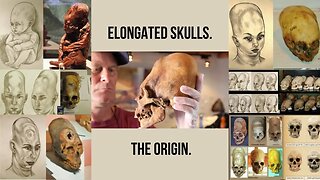 The Origins of Elongated Skulls