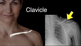 Clavicle