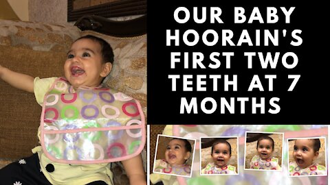 OUR BABY HOORAIN'S FIRST TWO TEETH AT 7th MONTHS | HOORAIN'S WORLD | HOORAIN KI DUYNAY | MANO BILLI