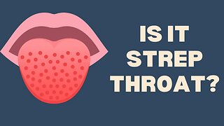 Strep Throat | 10 Symptoms You Can't Ignore #sick #symptoms #signs #strepthroat