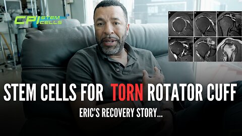 Stem Cells for Torn Rotator Cuff? - Eric's Recovery Story (HE AVOIDED SURGERY!)