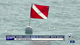 Diver loses an arm in accident with boat off Palm Beach