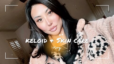 All Talks About Keloid, Tretinoin, Skin Care Health